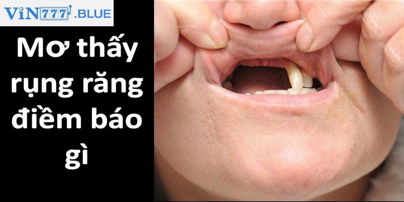 Điềm báo khi nằm mơ thấy rụng răng